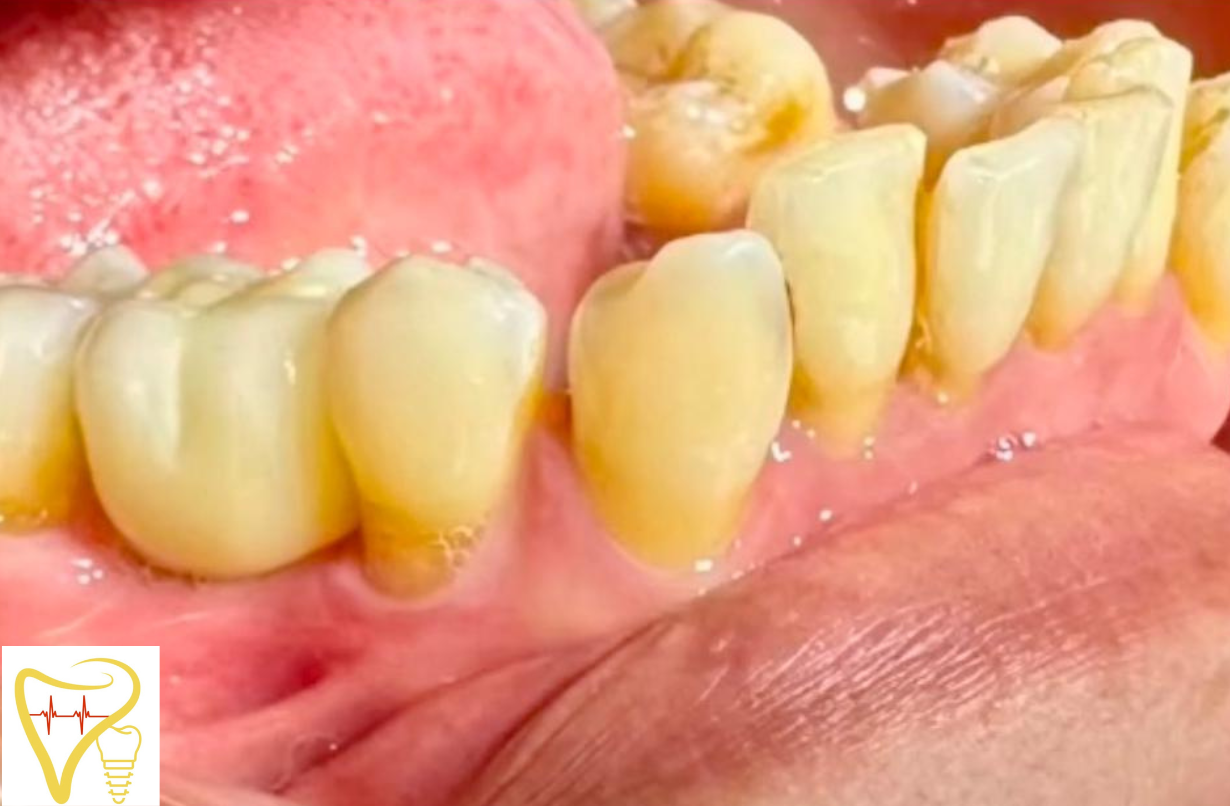 Centre Dentaire Bayaddou Wiame temara maroc