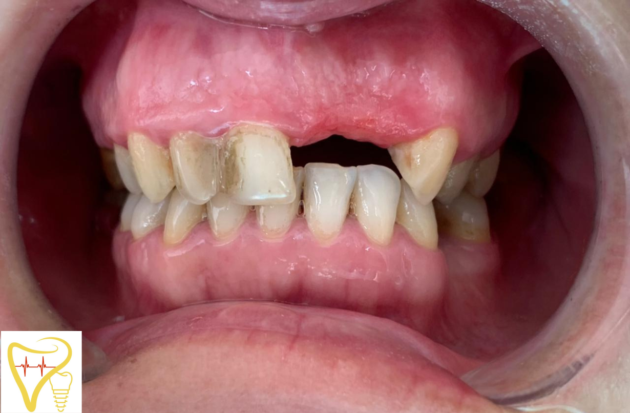 Centre Dentaire Bayaddou Wiame temara maroc