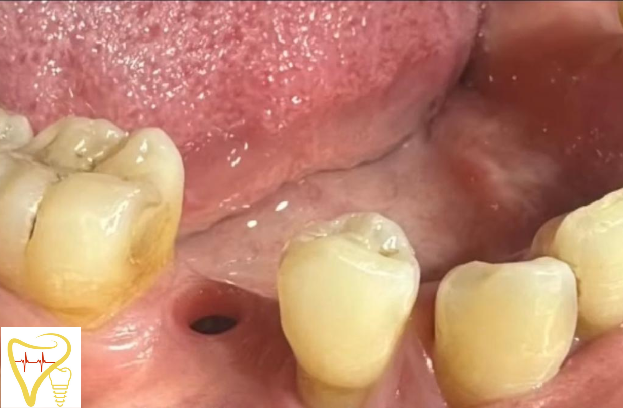 Centre Dentaire Bayaddou Wiame temara maroc